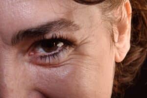 Detail of wrinkles in a woman's eyes