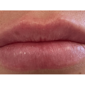 After Image: Lips