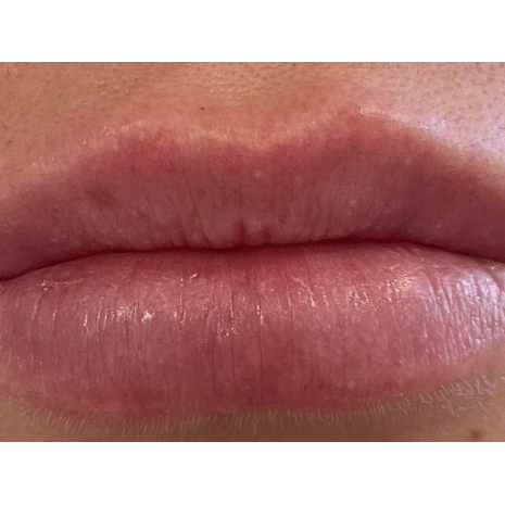 After Image: Lips - front