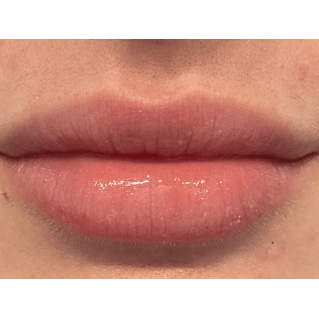 After Image: Lips - front