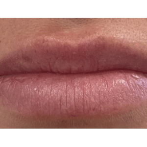 Before Image: Lips