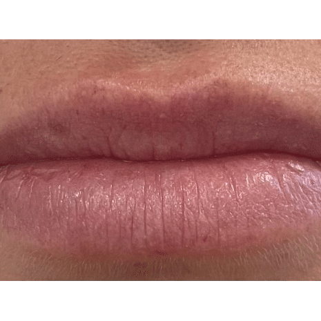 Before Image: Lips - front