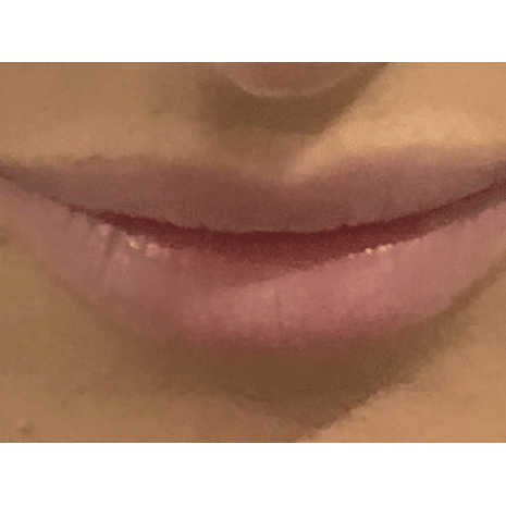 Before Image: Lips - front