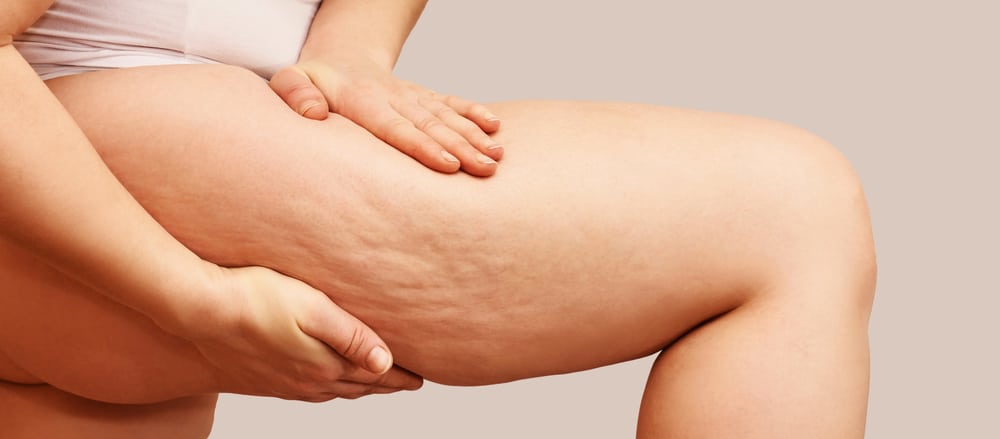 A close-up shot of cellulite on a woman’s thigh