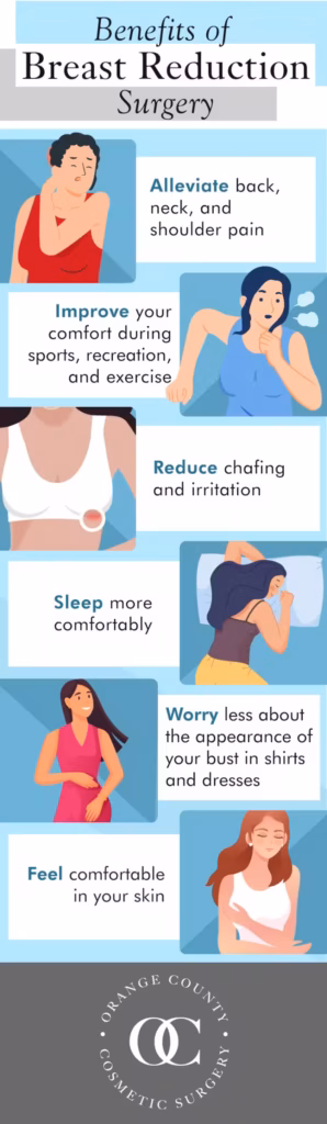 Breast Reduction in Huntington Beach & Costa Mesa, CA